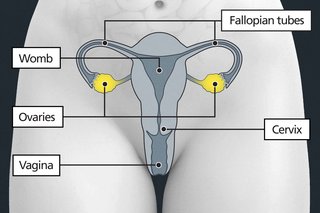 Diagram of the pelvic area with labels showing the cervix, womb, fallopian tubes and 2 ovaries. The ovaries are either side of the womb.